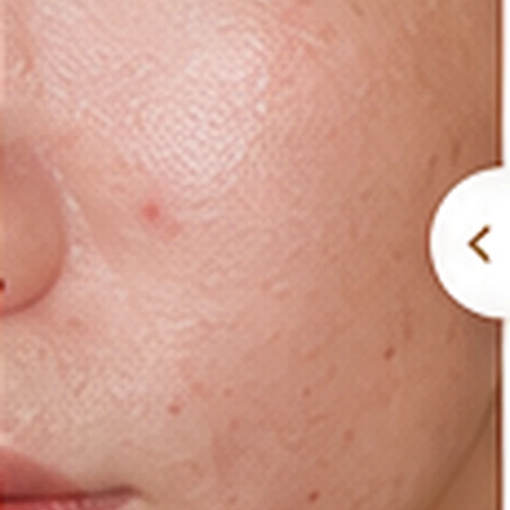 Illustrative dehydrated skin look before sheet mask use